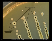 lactose negative colonies on deoxycholate agar